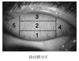 軟性接觸鏡臨床評價注冊審查指導原則（2023年第33號）(圖1)