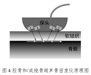 超聲骨密度儀注冊技術(shù)審查指導(dǎo)原則（2017年第180號(hào)）(圖4)