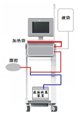 腹膜透析設(shè)備注冊(cè)審查指導(dǎo)原則（2024年修訂版）（2024年第19號(hào)）(圖2)