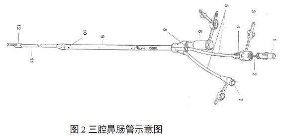 經(jīng)鼻腸營養(yǎng)導(dǎo)管注冊審查指導(dǎo)原則（2022年第41號）(圖2)