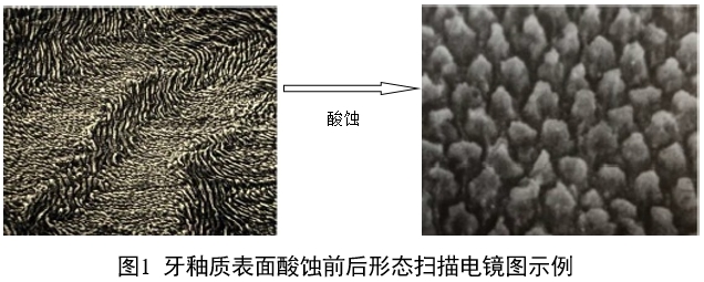 牙科用磷酸酸蝕劑注冊審查指導(dǎo)原則（2022年第41號(hào)）(圖1)