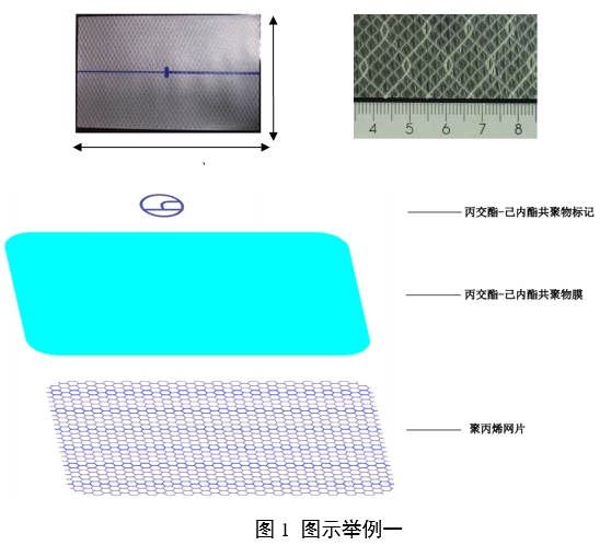 疝修補(bǔ)補(bǔ)片注冊審查指導(dǎo)原則（2023年修訂版）（2023年第9號）(圖4)