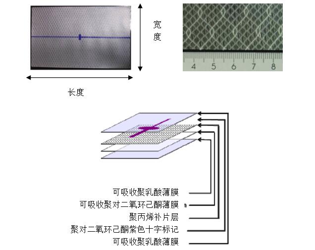 疝修補補片產(chǎn)品注冊技術(shù)審查指導(dǎo)原則（2013年第7號）(圖2)