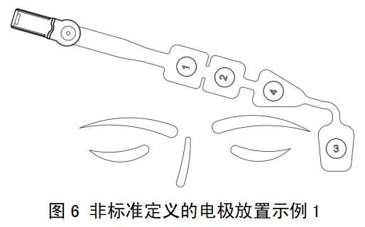 一次性使用腦電電極注冊(cè)審查指導(dǎo)原則（2022年第35號(hào)）(圖5)