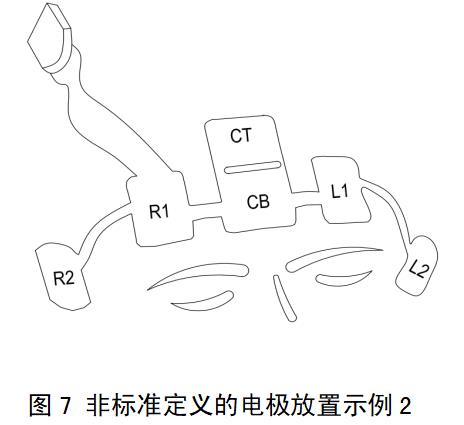 一次性使用腦電電極注冊(cè)審查指導(dǎo)原則（2022年第35號(hào)）(圖6)